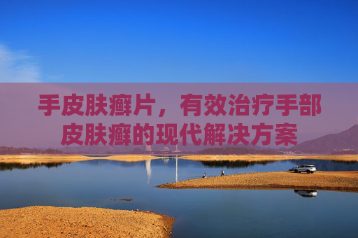 手皮肤癣片，有效治疗手部皮肤癣的现代解决方案