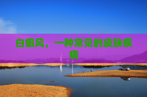白癜风，一种常见的皮肤疾病