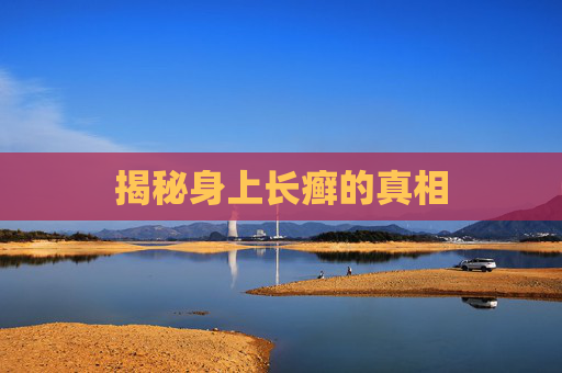 揭秘身上长癣的真相 揭秘身上长癣的真相